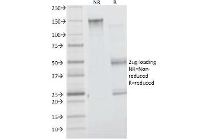SDS-PAGE Analysis Purified Insulin Receptor Mouse Monoclonal Antibody (INSR/1661). (Insulin Receptor anticorps  (Extracellular Domain))