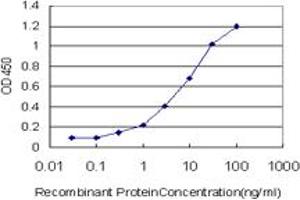 Detection limit for recombinant GST tagged ZBED1 is approximately 0.