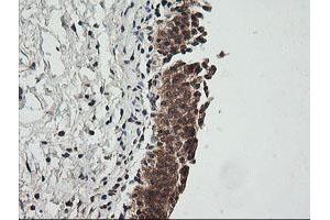 Image no. 2 for anti-Cyclin-Dependent Kinase Inhibitor 2B (p15, Inhibits CDK4) (CDKN2B) antibody (ABIN1497447)