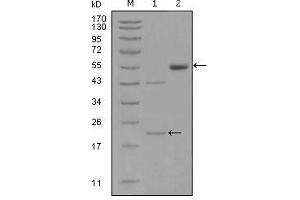 Western Blot showing EPHA5 antibody used against truncated EPHA5-His recombinant protein (1) and truncated EPHA5 (aa620-774)-hIgGFc transfected CHO-K1 cell lysate (2). (EPH Receptor A5 anticorps  (AA 620-774))