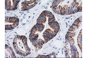 Image no. 1 for anti-Adenylate Kinase 4 (AK4) antibody (ABIN1496525)