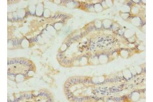 Immunohistochemistry of paraffin-embedded human small intestine tissue using ABIN7170170 at dilution of 1:100 (SLC23A1 anticorps  (AA 173-259))