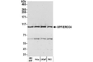 Western Blotting (WB) image for anti-Excision Repair Cross-Complementing Rodent Repair Deficiency, Complementation Group 4 (ERCC4) (AA 855-905) antibody (ABIN7450912)