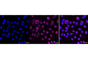 Immunocytochemical staining of HepG2 cells with KHSRP antibody (ABIN7799194), 1:1,000).