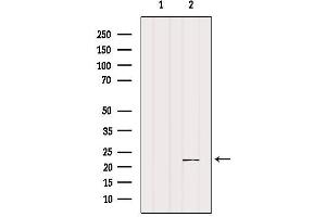 Western blot analysis of extracts from Mouse muscle, using SAR1A Antibody. (SAR1A anticorps  (Internal Region))