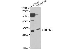 Western blot analysis of extracts of various cell lines, using MT-ND1 antibody. (MT-ND1 anticorps)