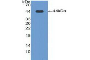 Detection of Recombinant BPI, Human using Polyclonal Antibody to Bactericidal/Permeability Increasing Protein (BPI)