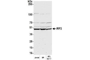Western Blotting (WB) image for anti-Interferon Regulatory Factor 2 (IRF2) (AA 150-200) antibody (ABIN7450960)