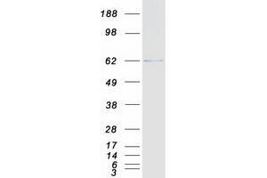 Validation with Western Blot
