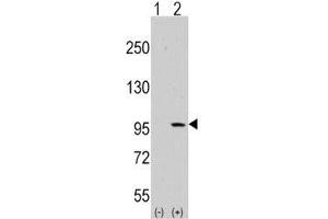 Western blot analysis of DDR1 antibody and 293 cell lysate (2 ug/lane) either nontransfected (Lane 1) or transiently transfected with the DDR1 gene (2). (DDR1 anticorps  (AA 299-330))