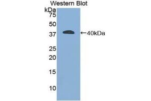 Detection of Recombinant GFAP, Mouse using Polyclonal Antibody to Glial Fibrillary Acidic Protein (GFAP) (GFAP anticorps  (AA 253-354))