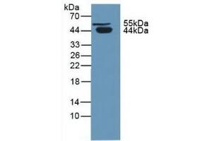 Detection of PCI in Human Urine using Polyclonal Antibody to Protein C Inhibitor (PCI)