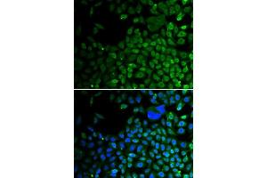 Immunofluorescence analysis of A549 cells using HDAC2 antibody. (HDAC2 anticorps  (C-Term))