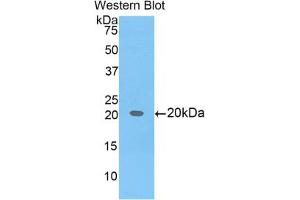 Western blot analysis of the recombinant protein. (BCL2L2 anticorps  (AA 22-189))
