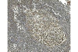 IHC analysis of Hsc70 using anti-Hsc70 antibody (ABIN7601962). (Hsc70 anticorps  (AA 520-614))