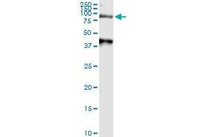 anti-Arylsulfatase A (ARSA) (AA 1-507) antibody