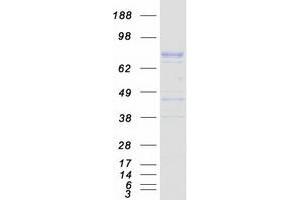 Validation with Western Blot