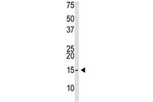 SUMO-3 antibody used in western blot to detect SUMO3 in Saos-2 cell lysate