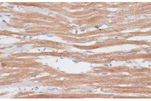 Immunohistochemistry of paraffin-embedded Rat heart using KATNA1 Polyclonal Antibody at dilution of 1:100 (40x lens). (KATNA1 anticorps)