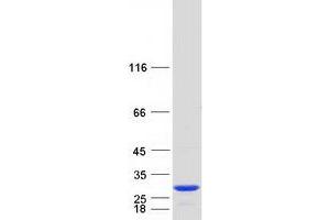Validation with Western Blot (C1ORF50 Protein (Myc-DYKDDDDK Tag))