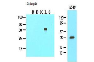 Western Blotting (WB) image for anti-Cathepsin L1 (CTSL1) (AA 114-333) antibody (ABIN317509) (Cathepsin L anticorps  (AA 114-333))