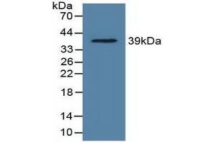 Western blot analysis of recombinant Rat LDHC. (Lactate Dehydrogenase C anticorps  (AA 1-332))