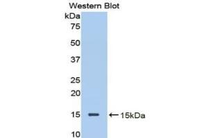 Western blot analysis of the recombinant protein. (Decorin anticorps  (AA 45-152))