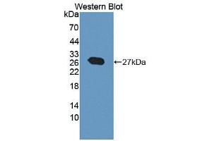 Figure. (PFKP anticorps  (AA 354-570))