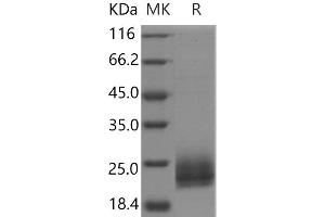 Western Blotting (WB) image for Niemann-Pick Disease, Type C2 (NPC2) protein (His tag) (ABIN7321066) (NPC2 Protein (His tag))