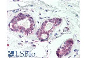 ABIN1590075 (5µg/ml) staining of paraffin embedded Human Breast. (HOXC10 anticorps  (Internal Region))