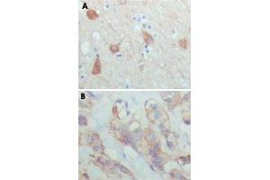 Immunohistochemical analysis of paraffin-embedded human brain (A) and breast carcinoma (B), showing cytoplasmic and membrane localization using PAWR monoclonal antibody, clone 3G9H7  with DAB staining. (PAWR anticorps)