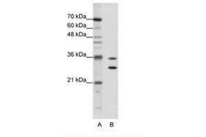 Image no. 1 for anti-Methenyltetrahydrofolate Synthetase Domain Containing (MTHFSD) (AA 60-109) antibody (ABIN202358) (MTHFSD anticorps  (AA 60-109))
