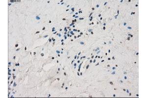 Immunohistochemical staining of paraffin-embedded Ovary tissue using anti-FCGR2A mouse monoclonal antibody. (FCGR2A anticorps)