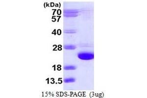 SDS-PAGE (SDS) image for Cofilin 2 (CFL2) (AA 1-166) protein (His tag) (ABIN667534)