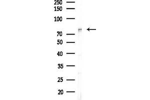 Western blot analysis of lysates from Hela cells(heat-shock,45 min treatment), using CHML Antibody at 1/1000 dilution.