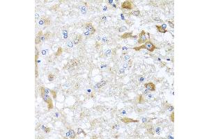 Immunohistochemistry of paraffin-embedded rat brain using ABCB8 antibody at dilution of 1:100 (x40 lens). (ABCB8 anticorps)