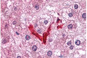 Human Liver, Kupffer Cells (formalin-fixed, paraffin-embedded) stained with DOK2 antibody ABIN214096 at 5 ug/ml followed by biotinylated goat anti-rabbit IgG secondary antibody ABIN481713, alkaline phosphatase-streptavidin and chromogen.