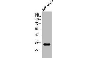 Western Blot analysis of RAT-musle cells using Phospho-DARPP-32 (T34) Polyclonal Antibody (DARPP32 anticorps  (pThr34))