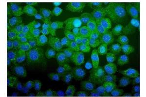 IF analysis of CDC123 using anti-CDC123 antibody (ABIN7599284). (CDC123 anticorps  (AA 1-336))