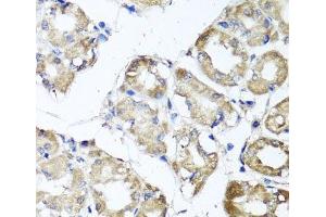 Immunohistochemistry of paraffin-embedded Human stomach using MGAT1 Polyclonal Antibody at dilution of 1:100 (40x lens). (MGAT1 anticorps)