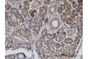 Immunoperoxidase of monoclonal antibody to MSRA on formalin-fixed paraffin-embedded human salivary gland. (MSRA anticorps  (AA 1-100))