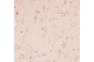 Anti-Tuberin Picoband antibody,  IHC(P): Mouse Brain Tissue