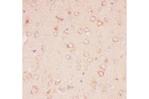 Anti-Tuberin Picoband antibody,  IHC(P): Mouse Brain Tissue