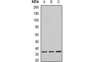 Western blot analysis of eIF2B1 expression in SHSY5Y (A), MCF7 (B), mouse liver (C), mouse brain (D) whole cell lysates. (EIF2B1 anticorps)