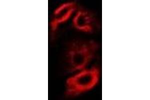 Immunofluorescent analysis of RPS10 staining in A549 cells.