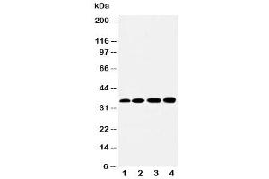 Western blot testing of HSD17B1 antibody and Lane 1:  rat kidney