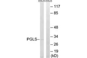 Western blot analysis of extracts from COLO cells, using PGLS Antibody.