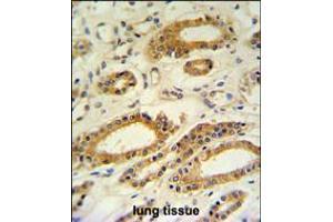 DDO Antibody IHC analysis in formalin fixed and paraffin embedded lung tissue followed by peroxidase conjugation of the secondary antibody and DAB staining.
