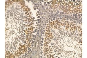 Phospho-E2F1 (Thr433) Mouse Monoclonal Antibody at 1/100 staining rat testis tissue by IHC-P. (E2F1 anticorps  (pThr433))
