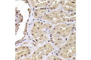 Immunohistochemistry of paraffin-embedded human kidney using RPS5 antibody at dilution of 1:100 (x400 lens). (RPS5 anticorps)